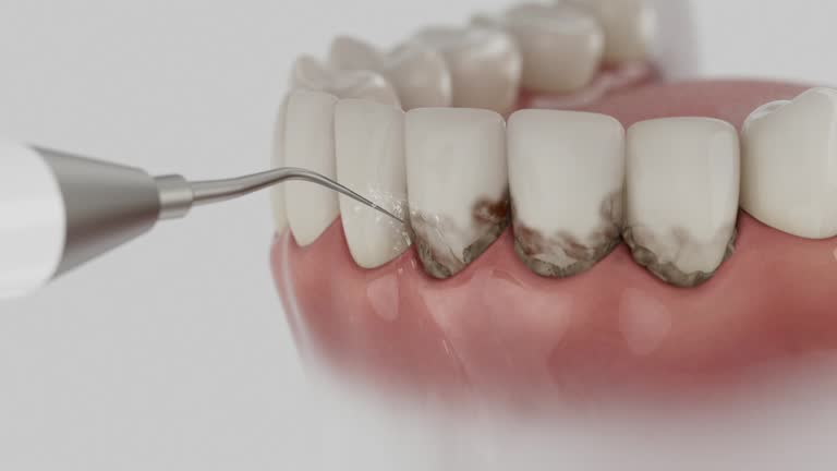 Trusted Teeth Cleaning And Checkup service in McElhattan, PA - Dentist Open Now